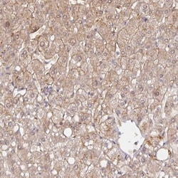 HEPN1 Antibody, Novus Biologicals 0.1mL; Unlabeled:Antibodies, Polyclonal